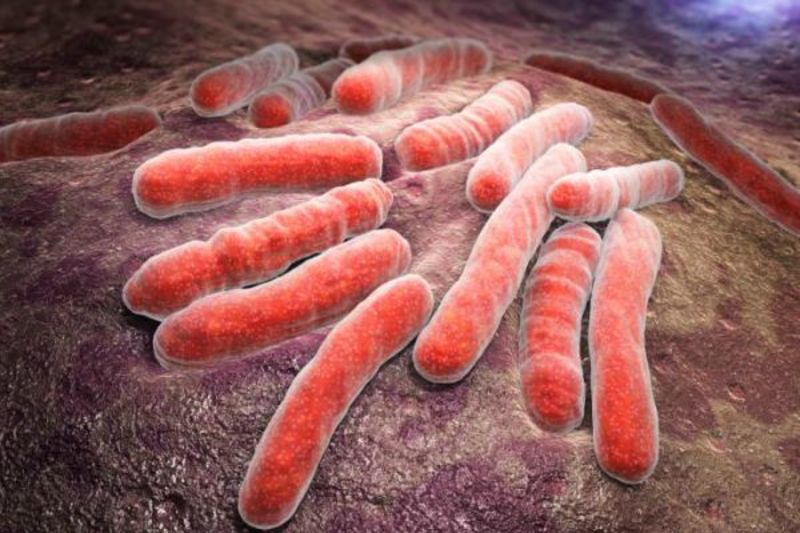 Hình ảnh minh họa vi khuẩn lao Mycobacterium tuberculosis